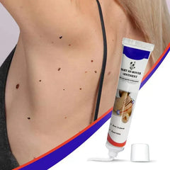 Warts Remover ointment