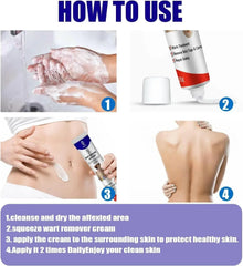 Warts Remover ointment